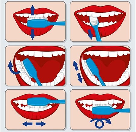 مسواک زدن صحیح و نکات مهم | کلینیک تخصصی دندانپزشکی Dencare