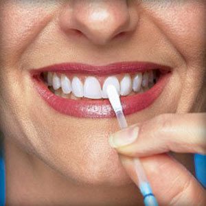 سفید کردن و حساسیت دندان